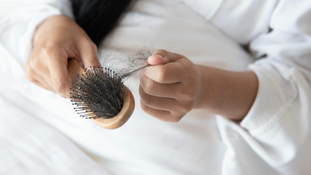 What is the difference between hair loss and hair shedding